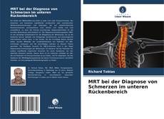 Capa do livro de MRT bei der Diagnose von Schmerzen im unteren Rückenbereich 