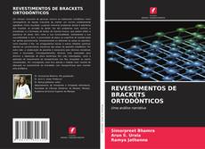 Bookcover of REVESTIMENTOS DE BRACKETS ORTODÔNTICOS