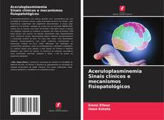 Bookcover of Aceruloplasminemia Sinais clínicos e mecanismos fisiopatológicos