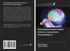 Bookcover of Aceruloplasminemia Signos clínicos y mecanismos fisiopatológicos
