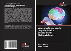 Buchcover von Aceruloplasminemia Segni clinici e meccanismi fisiopatologici