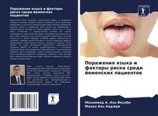 Bookcover of Поражения языка и факторы риска среди йеменских пациентов