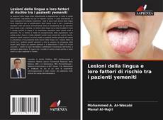 Bookcover of Lesioni della lingua e loro fattori di rischio tra i pazienti yemeniti