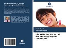 Bookcover of Die Rolle des Lacks bei der Vorbeugung von Zahnkaries