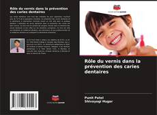 Capa do livro de Rôle du vernis dans la prévention des caries dentaires 