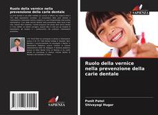 Bookcover of Ruolo della vernice nella prevenzione della carie dentale
