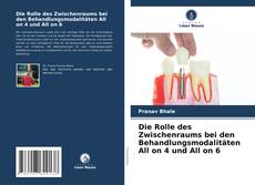 Buchcover von Die Rolle des Zwischenraums bei den Behandlungsmodalitäten All on 4 und All on 6
