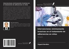 Bookcover of Intervenciones mínimamente invasivas en el tratamiento de adherencias en niños