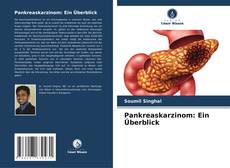 Pankreaskarzinom: Ein Überblick kitap kapağı