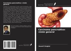 Bookcover of Carcinoma pancreático: visión general