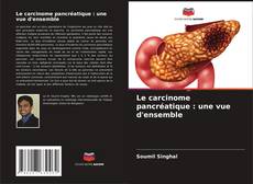 Bookcover of Le carcinome pancréatique : une vue d'ensemble