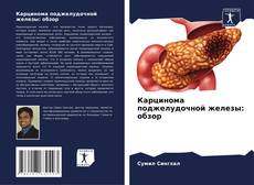 Карцинома поджелудочной железы: обзор kitap kapağı
