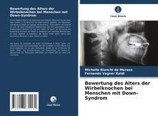 Bookcover of Bewertung des Alters der Wirbelknochen bei Menschen mit Down-Syndrom