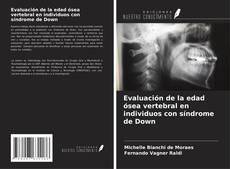 Evaluación de la edad ósea vertebral en individuos con síndrome de Down的封面