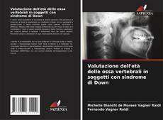 Capa do livro de Valutazione dell'età delle ossa vertebrali in soggetti con sindrome di Down 