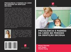 Buchcover von PREVALÊNCIA E PADRÃO DA CÁRIE NO PERÍODO DA DENTIÇÃO DECÍDUA