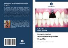 Fortschritte bei implantatchirurgischen Eingriffen kitap kapağı