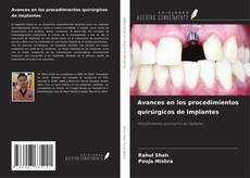 Buchcover von Avances en los procedimientos quirúrgicos de implantes