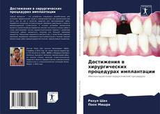 Copertina di Достижения в хирургических процедурах имплантации