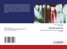 Bookcover of Dental Cements