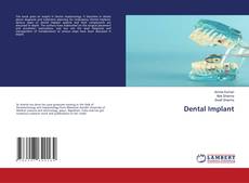 Обложка Dental Implant