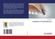 Implants in Prosthodontics的封面