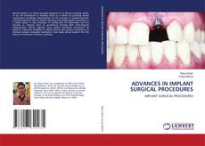 Bookcover of ADVANCES IN IMPLANT SURGICAL PROCEDURES