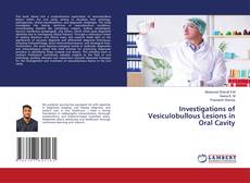 Buchcover von Investigations of Vesiculobullous Lesions in Oral Cavity