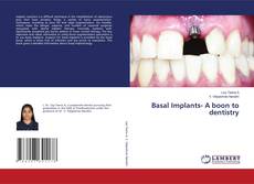 Buchcover von Basal Implants- A boon to dentistry