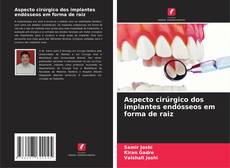 Capa do livro de Aspecto cirúrgico dos implantes endósseos em forma de raiz 