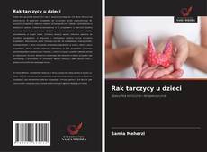 Rak tarczycy u dzieci的封面
