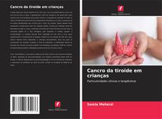 Cancro da tiroide em crianças的封面