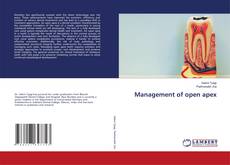 Copertina di Management of open apex