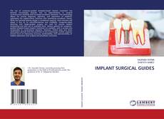 Bookcover of IMPLANT SURGICAL GUIDES