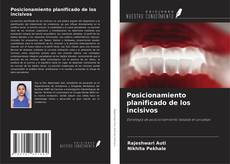 Copertina di Posicionamiento planificado de los incisivos