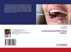 Buchcover von Understanding White Spot Lesions