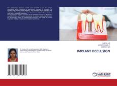 Capa do livro de IMPLANT OCCLUSION 