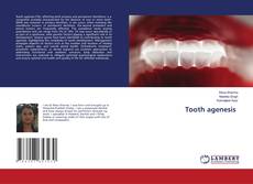 Capa do livro de Tooth agenesis 