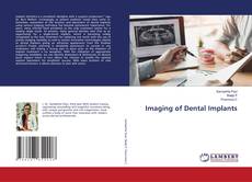 Borítókép a  Imaging of Dental Implants - hoz