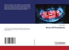 Borítókép a  Sinus Lift Procedures - hoz