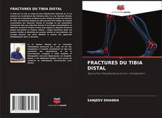 Bookcover of FRACTURES DU TIBIA DISTAL