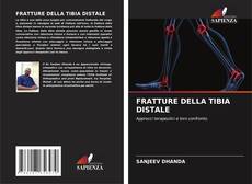 Buchcover von FRATTURE DELLA TIBIA DISTALE
