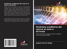 Bookcover of Sindrome ereditaria del cancro al seno e all'ovaio