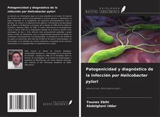 Bookcover of Patogenicidad y diagnóstico de la infección por Helicobacter pylori