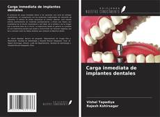 Обложка Carga inmediata de implantes dentales