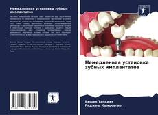 Немедленная установка зубных имплантатов kitap kapağı