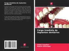 Bookcover of Carga imediata de implantes dentários