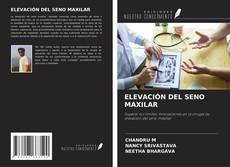 Обложка ELEVACIÓN DEL SENO MAXILAR