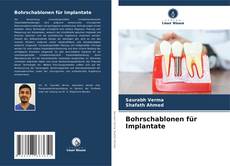 Bookcover of Bohrschablonen für Implantate