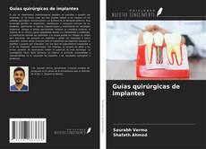 Buchcover von Guías quirúrgicas de implantes